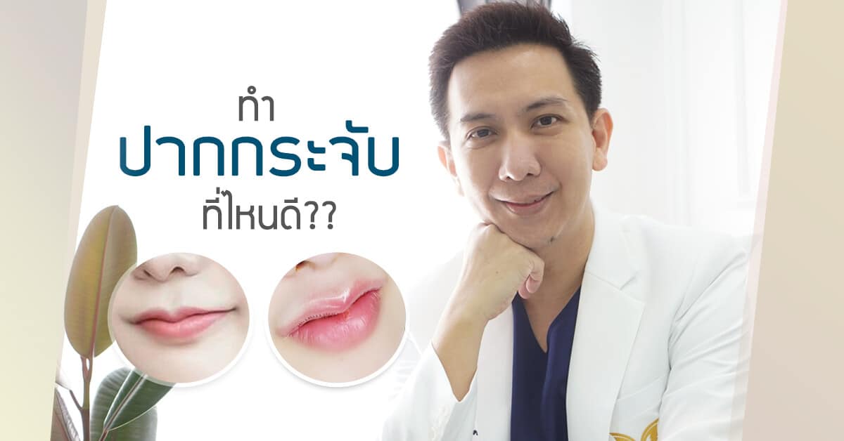 ทำปากกระจับ ที่ไหนดี - ศัลยกรรมปากกระจับ ศึกษาให้ดีก่อนทำ